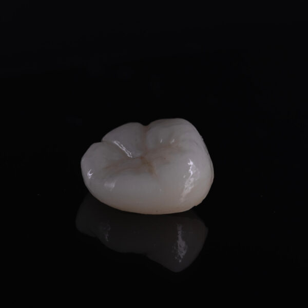 Corona Zirconia