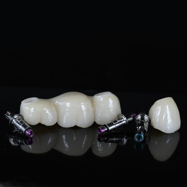 Puente sobre Implante Zirconia